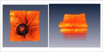 (Imágenes de la cabeza de un nervio óptico humano, a la izquierda de la superficie, y a la derecha tridimensionalmente.) (Foto: MIT Optics Group, J. Fujimoto)