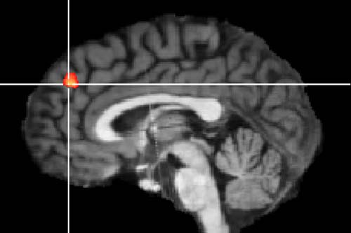 (Área del cerebro que se activó cuando los participantes detuvieron una acción intencionadamente, en el último momento.) (Foto: Max Planck Institute for Human Cognitive and Brain Sciences)