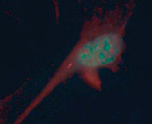 (La línea roja brillante es un cilio de una célula nerviosa sensorial.) (Foto: Johns Hopkins U.)