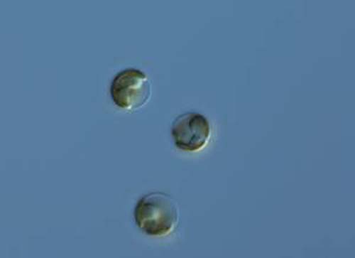 (El alga Phaeocystis, en solitario.) (Foto: Robert Andersen)